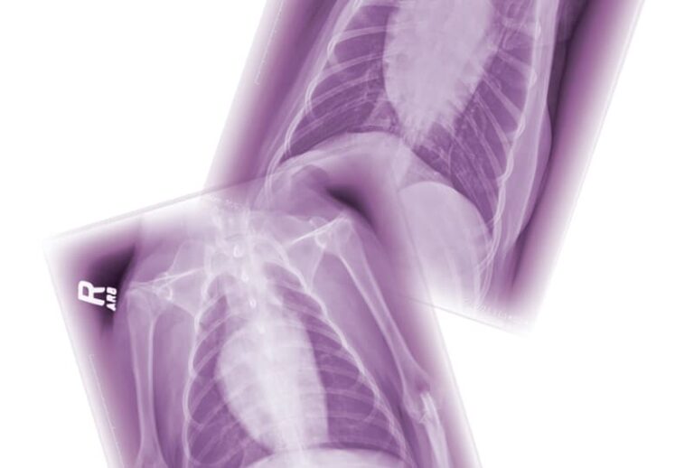 Small Animal Thoracic Radiography