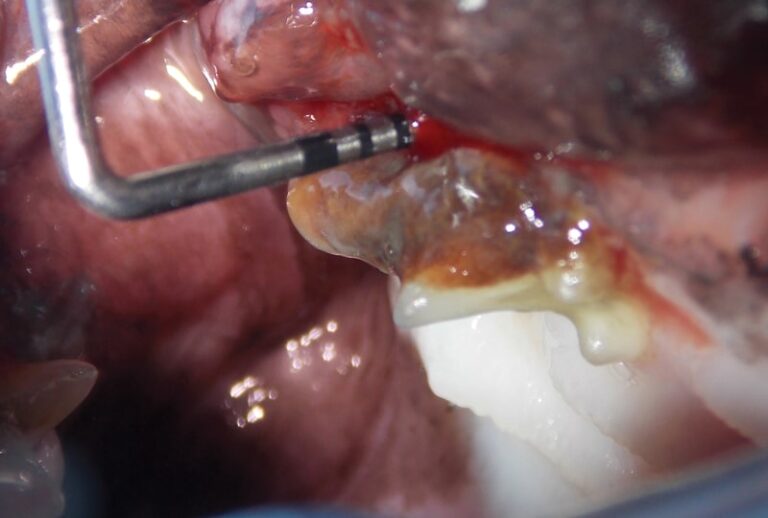 Cat with Calculus, Gingivitis, & Missing Teeth