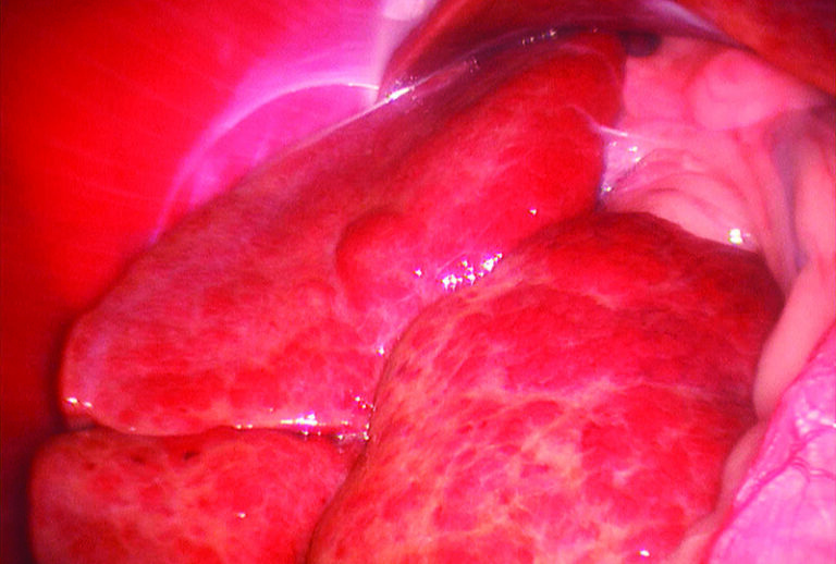 Canine Chronic Hepatitis: Diagnosis and Treatment