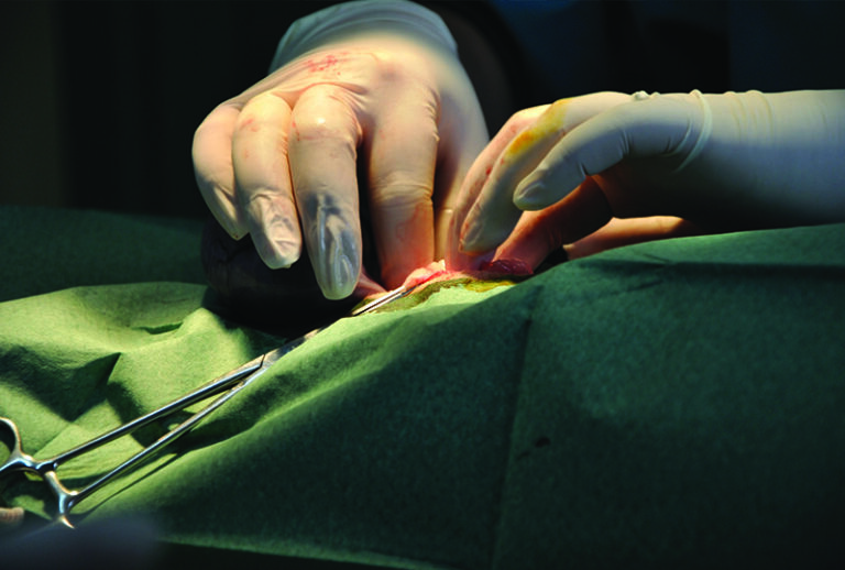 Creating a Leak-Proof Ligature with Confidence, Part 1: Overview of Ligation and Surgical Binding Knots
