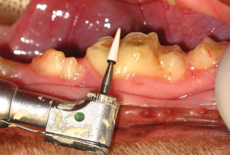 Bonded Sealant Application for Crown Fractures