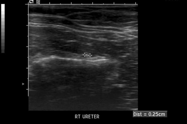 Feline Struvite and Calcium Oxalate Urolithiasis | Today's Veterinary ...