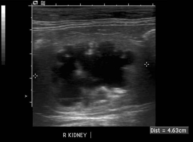 View of Feline Struvite and Calcium Oxalate Urolithiasis | Today's Veterinary ...