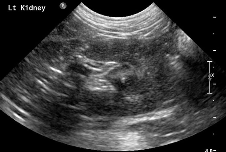 Small Animal Abdominal Ultrasonography, Part 1: A Tour of the Abdomen