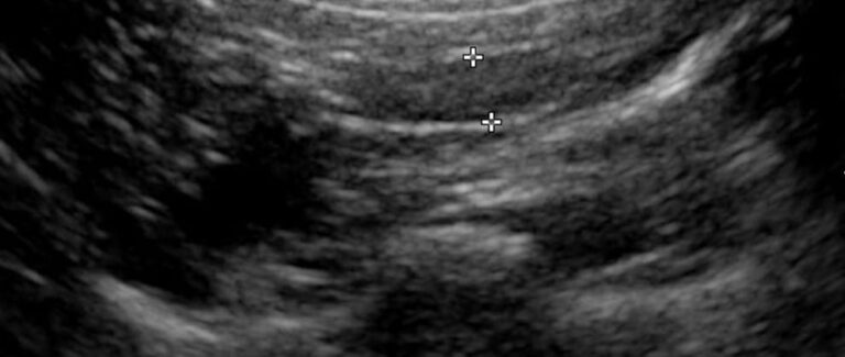 Small Animal Abdominal Ultrasonography,Part 2: A Tour of the Abdomen