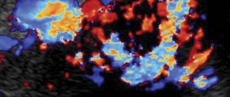 Small Animal Abdominal Ultrasonography, Part 2: Liver and Gallbladder