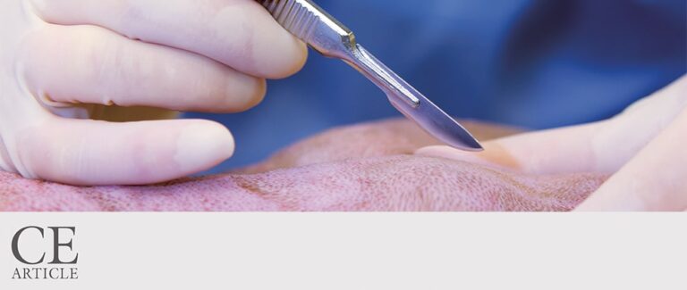 Lymphadenectomy: Overview of Surgical Anatomy and Removal of Peripheral Lymph Nodes