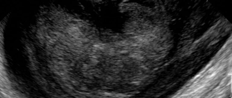 Small Animal Abdominal Ultrasonography, The Urinary Tract: Urinary Bladder and Urethra