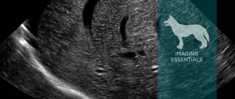 Ultrasonography of Peritoneal and Retroperitoneal Spaces and Abdominal Lymph Nodes