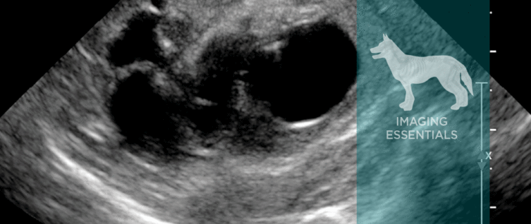 Ultrasonography of the Urinary Tract: Kidneys and Ureters