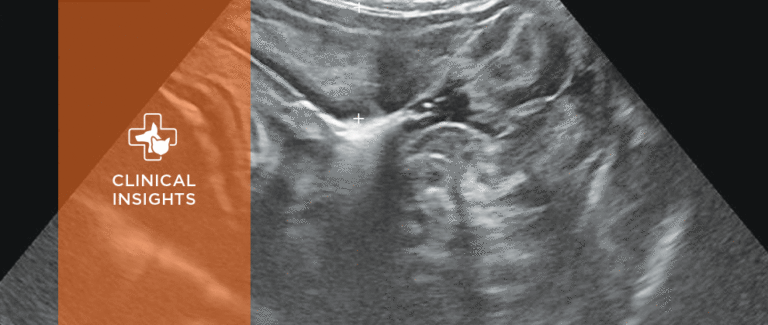 Ultrasonography of the Gastrointestinal Tract: Stomach, Duodenum, and Jejunum