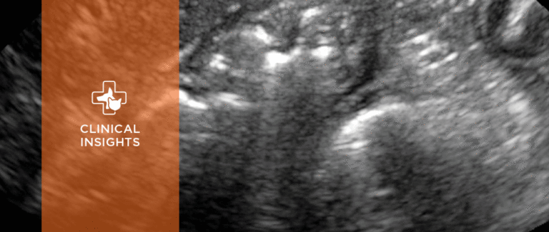 Ultrasonography of the Gastrointestinal Tract: Ileum, Cecum, Colon