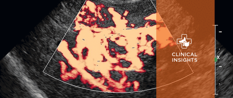 Ultrasonography of the Abdominal Vasculature