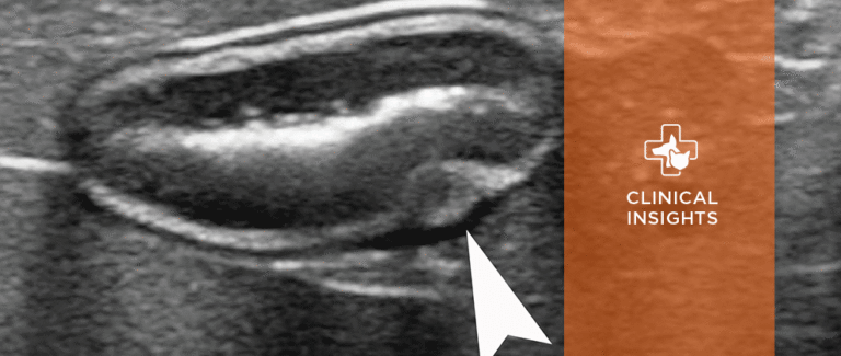 Ultrasonographic Differences Between Dogs and Cats