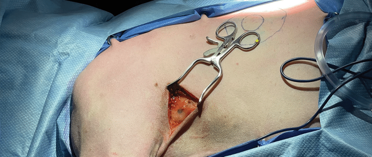 Lymph Node Mapping in Primary Care Practice