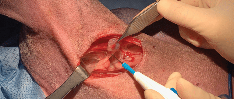 Axillary and Superficial Inguinal Lymphadenectomy: Anatomic Review and Step-by-Step Guide