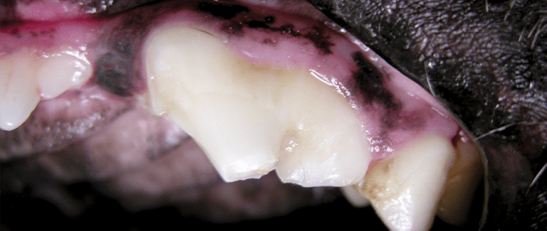 Algorithm for the Diagnosis and Treatment of Fractured Teeth