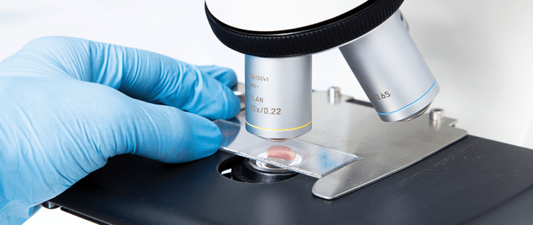 Blood Smear Review: A Step-by-Step Guide to Normal Findings for Cats and Dogs