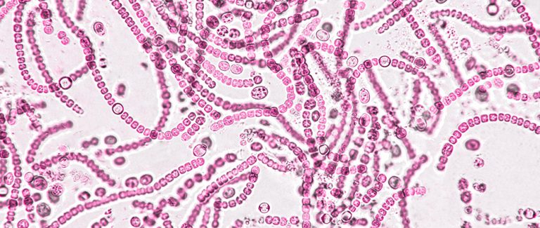 Protect the Gut: Probiotics, Antibiotics, and the Nuances of Managing GI Disease