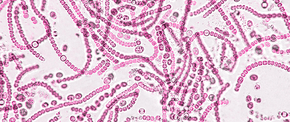 Protect the Gut: Probiotics, Antibiotics, and the Nuances of Managing GI Disease - Featured Image
